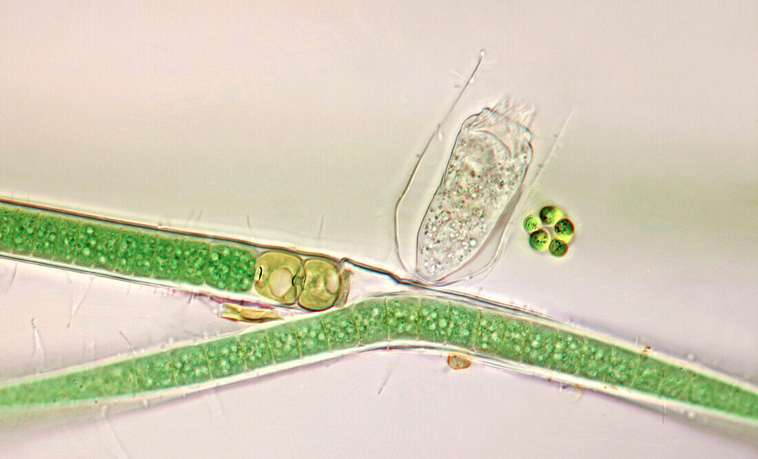 Vaginicola ciliate on cyanobacteria, light micrograph