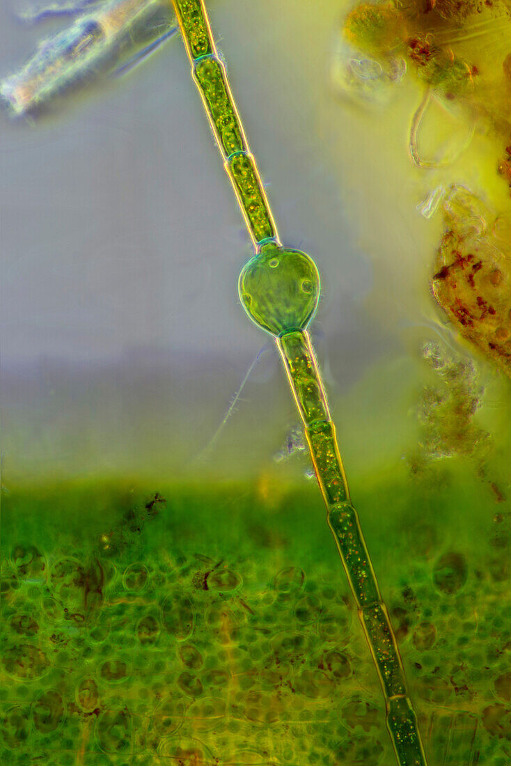 Oedogonium sp. green alga, light micrograph