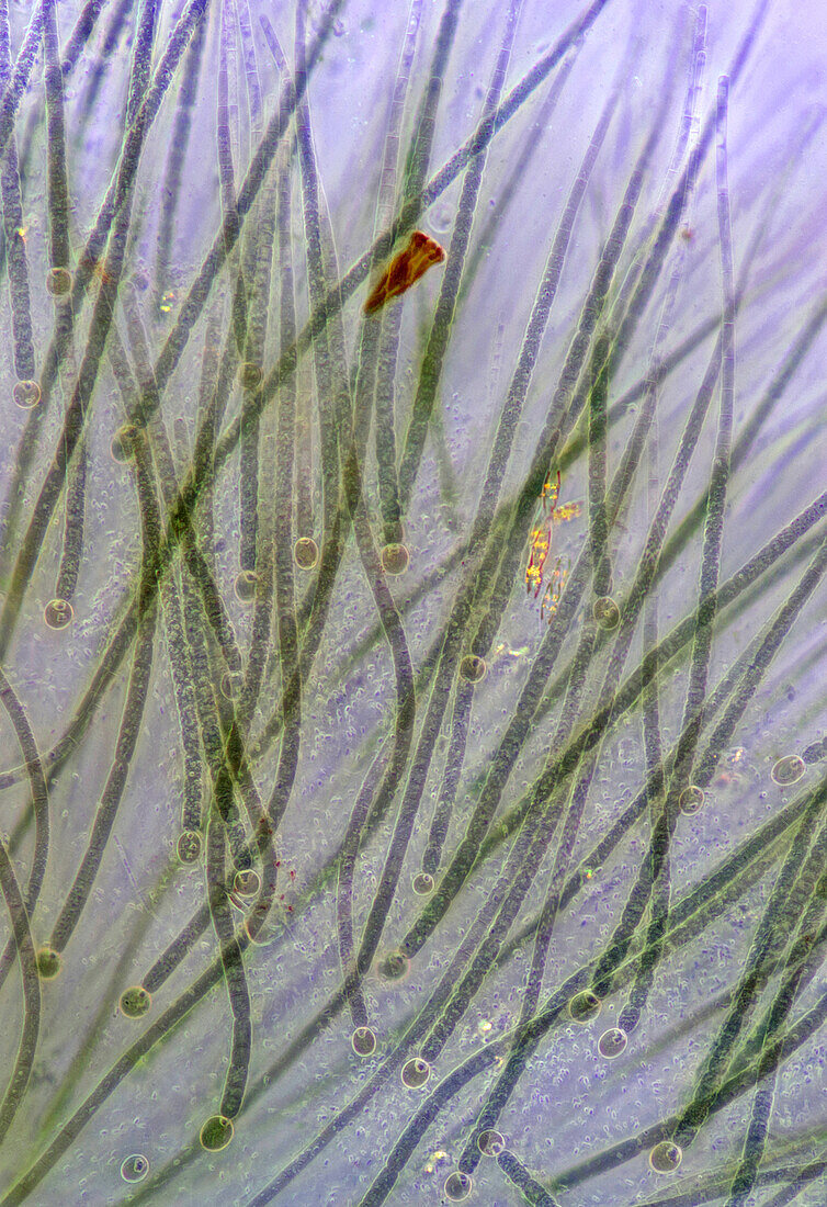 Rivularia cyanobacteria, light micrograph