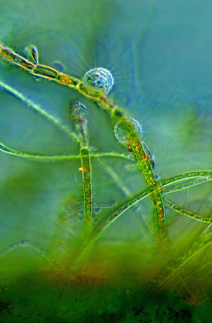 Heliozoans on green alga, light micrograph