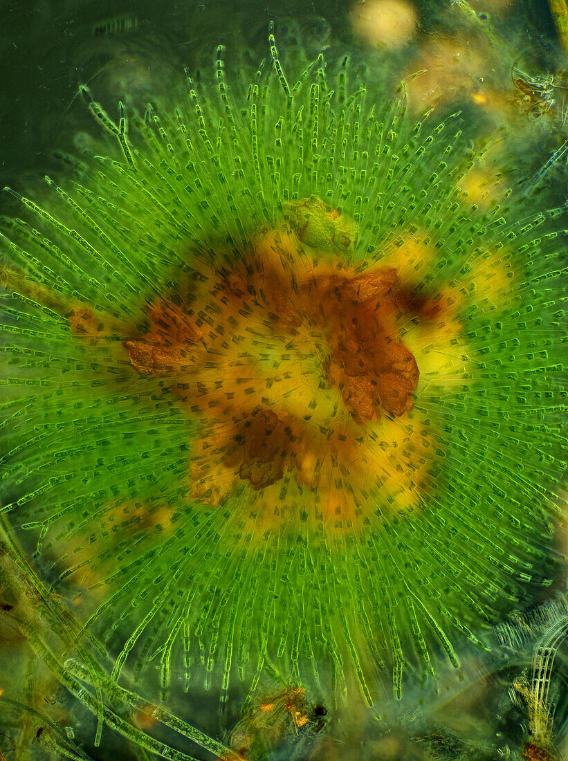 Green algae colony attached to sand grain, light micrograph