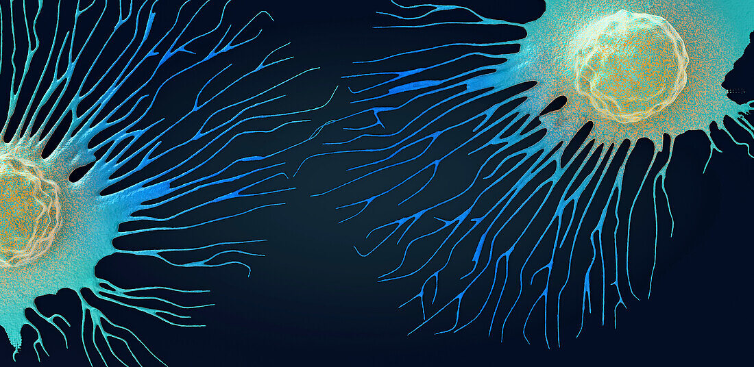 Spreading cancer cell, illustration