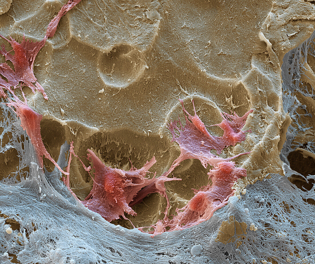 Osteoclast cells on bone, SEM