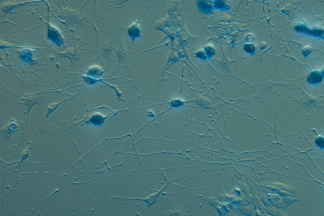 Trigeminal ganglion neurons, light micrograph