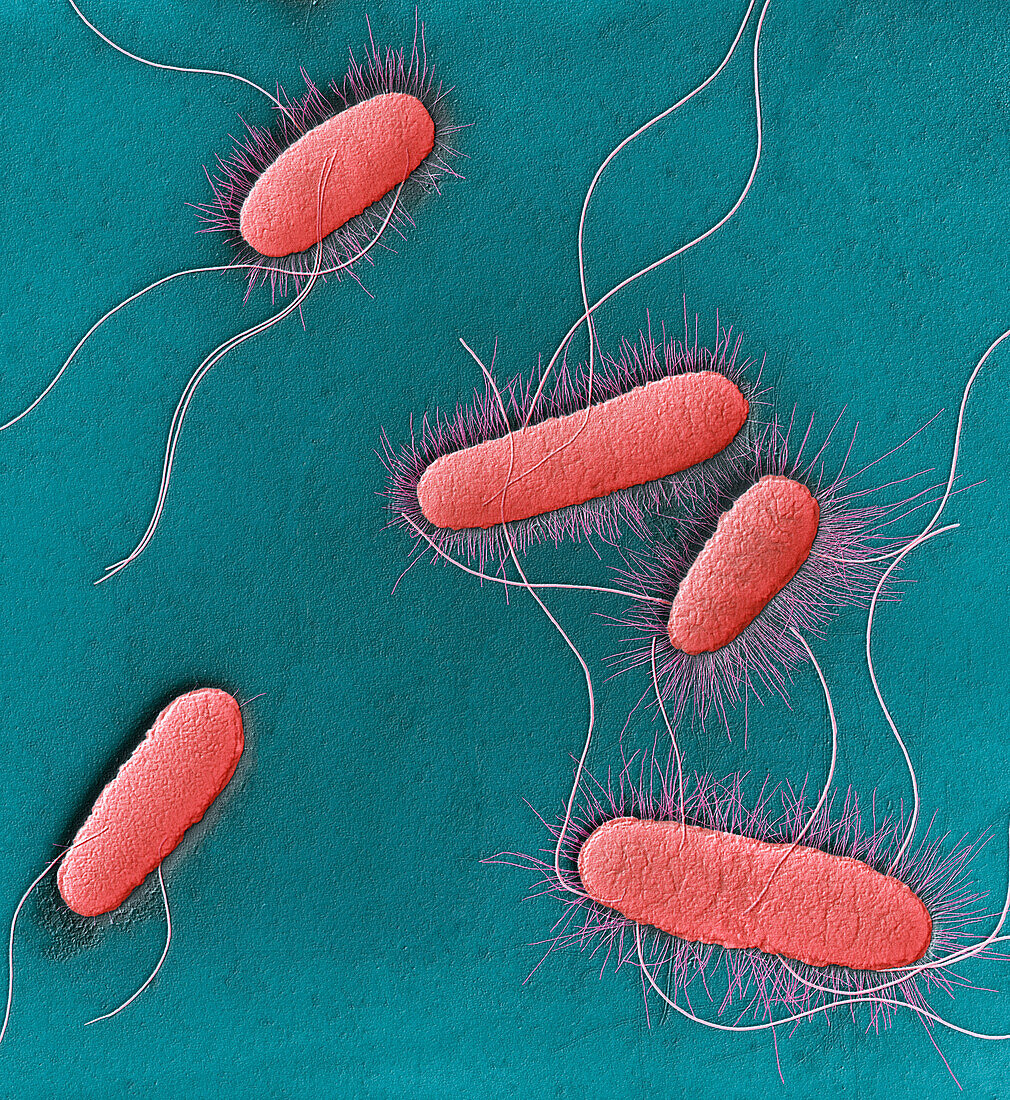 E. coli bacteria, TEM