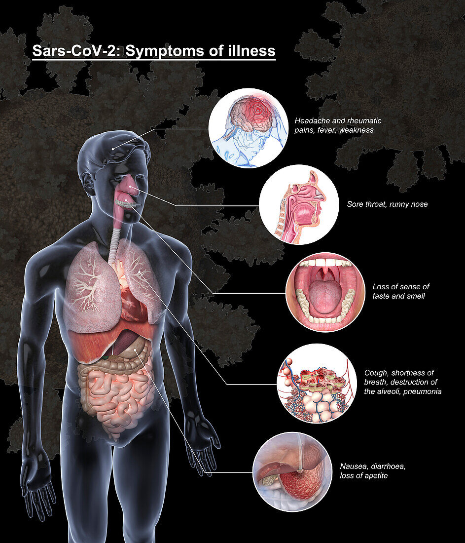 Covid-19 symptoms, illustration