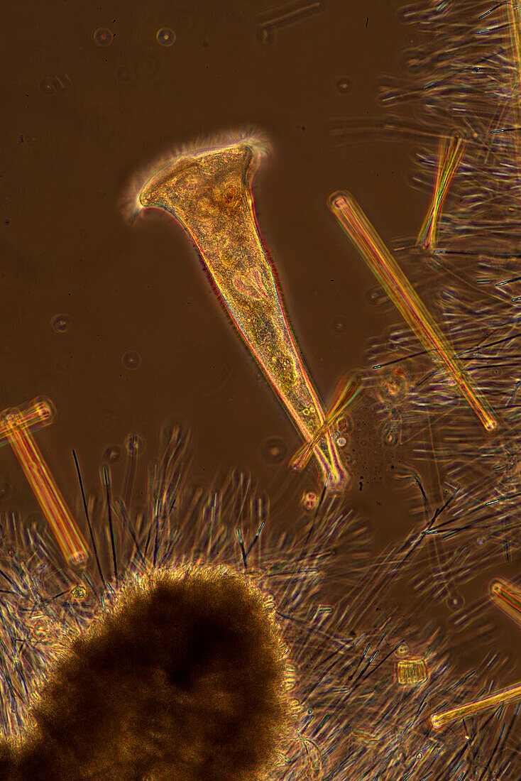 Stentor ciliate and red algae, light micrograph
