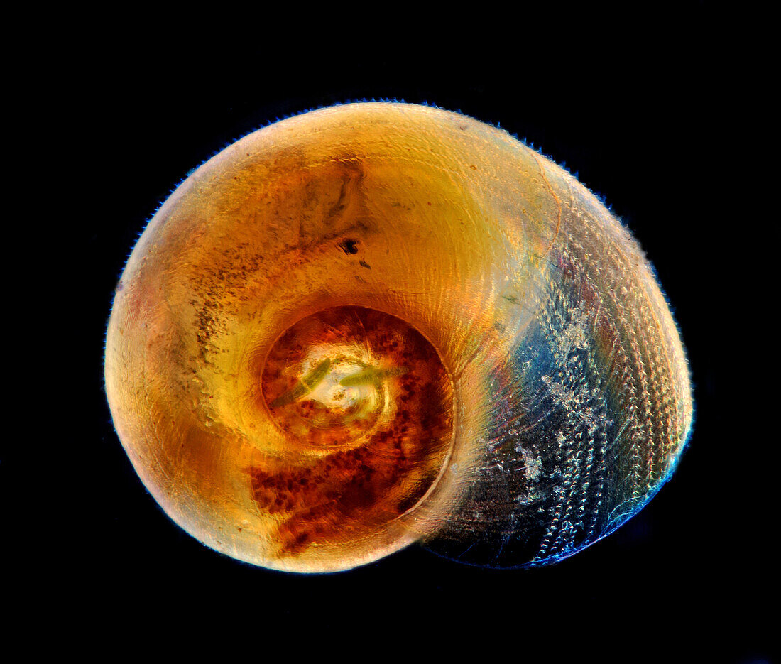 Aquatic snail, light micrograph