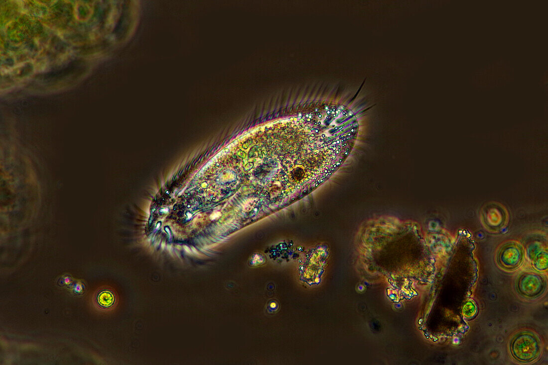 Stylonychia ciliate, light micrograph