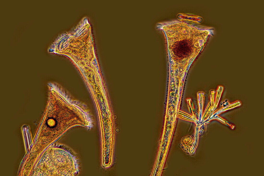 Stentors ciliate, light micrograph