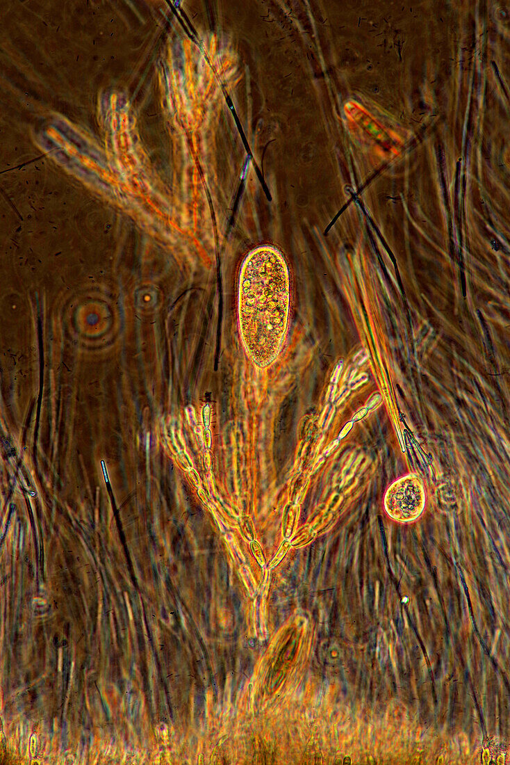 Ciliate and Batrachospermum red algae, light micrograph