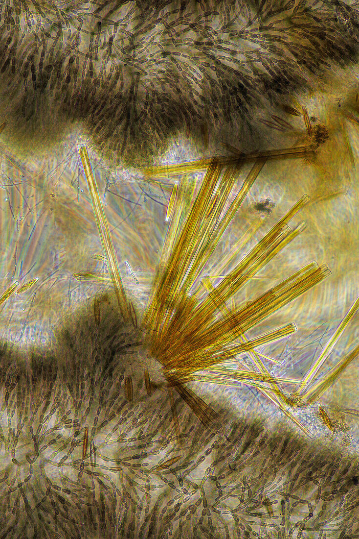 Batrachospermum red algae and diatoms, light micrograph