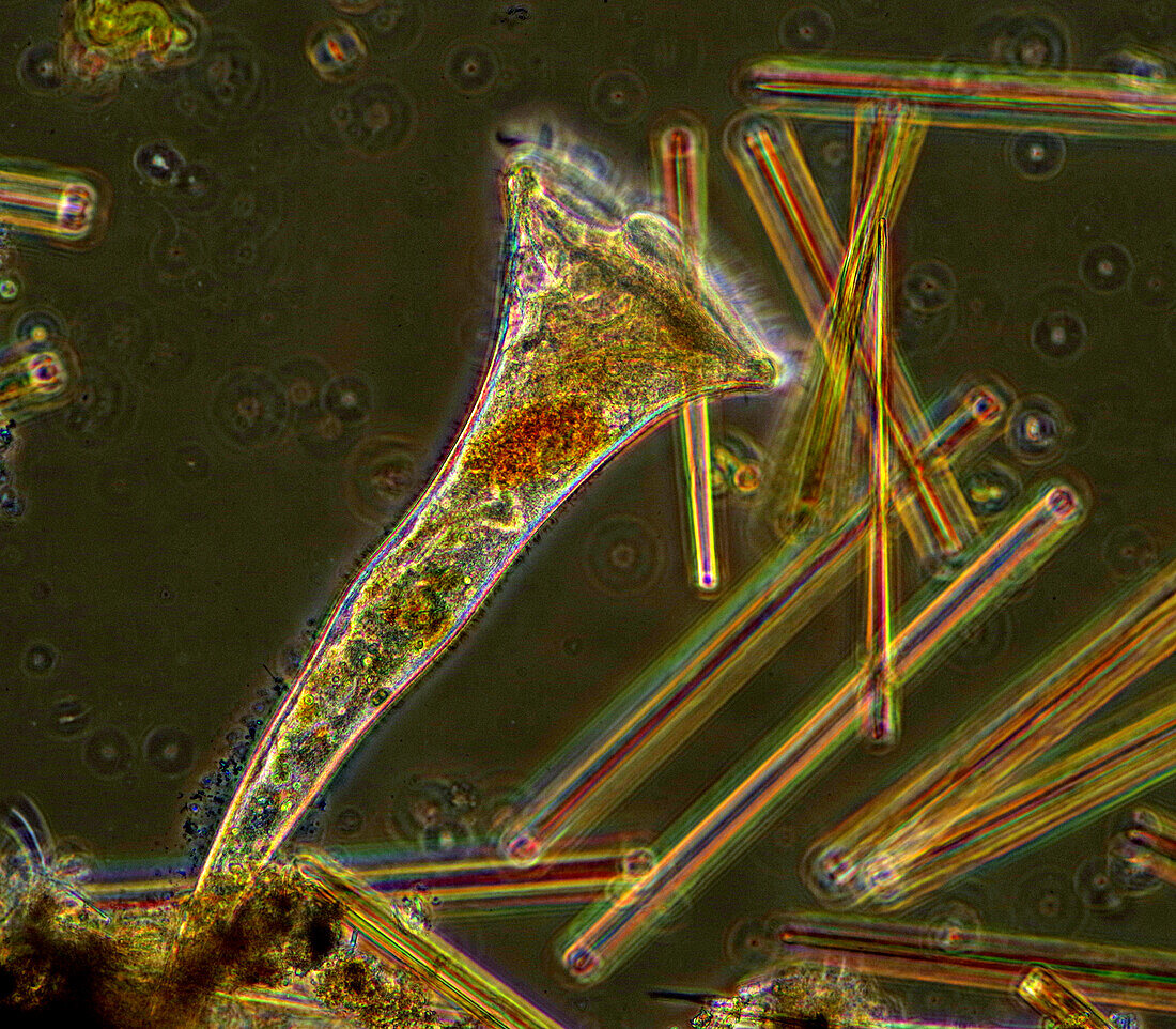 Stentor sp. ciliate and diatoms, light micrograph