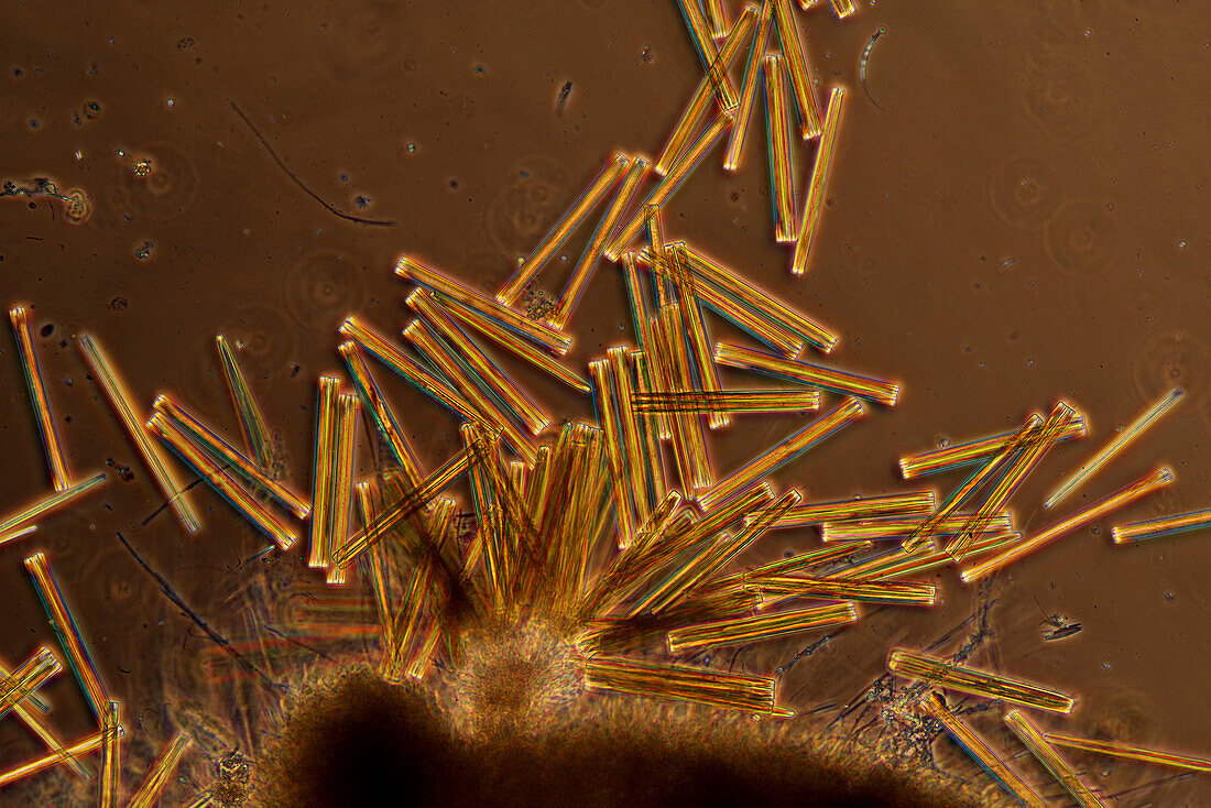 Synedra sp. diatoms, light micrograph