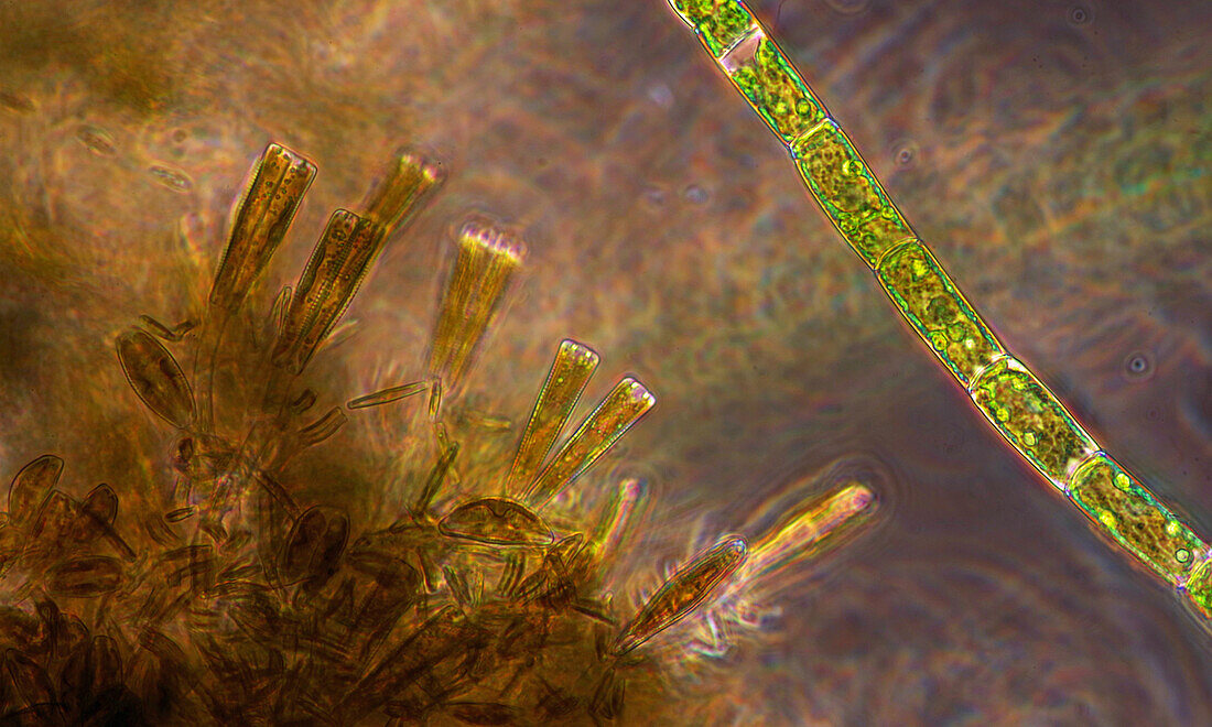 Gomphonema sp. diatoms and green alga, light micrograph