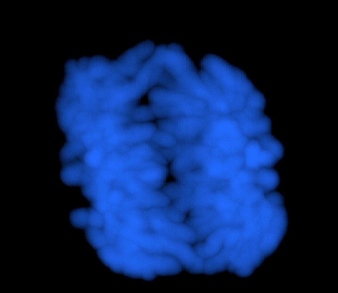 Human chromosomes in early anaphase, light micrograph