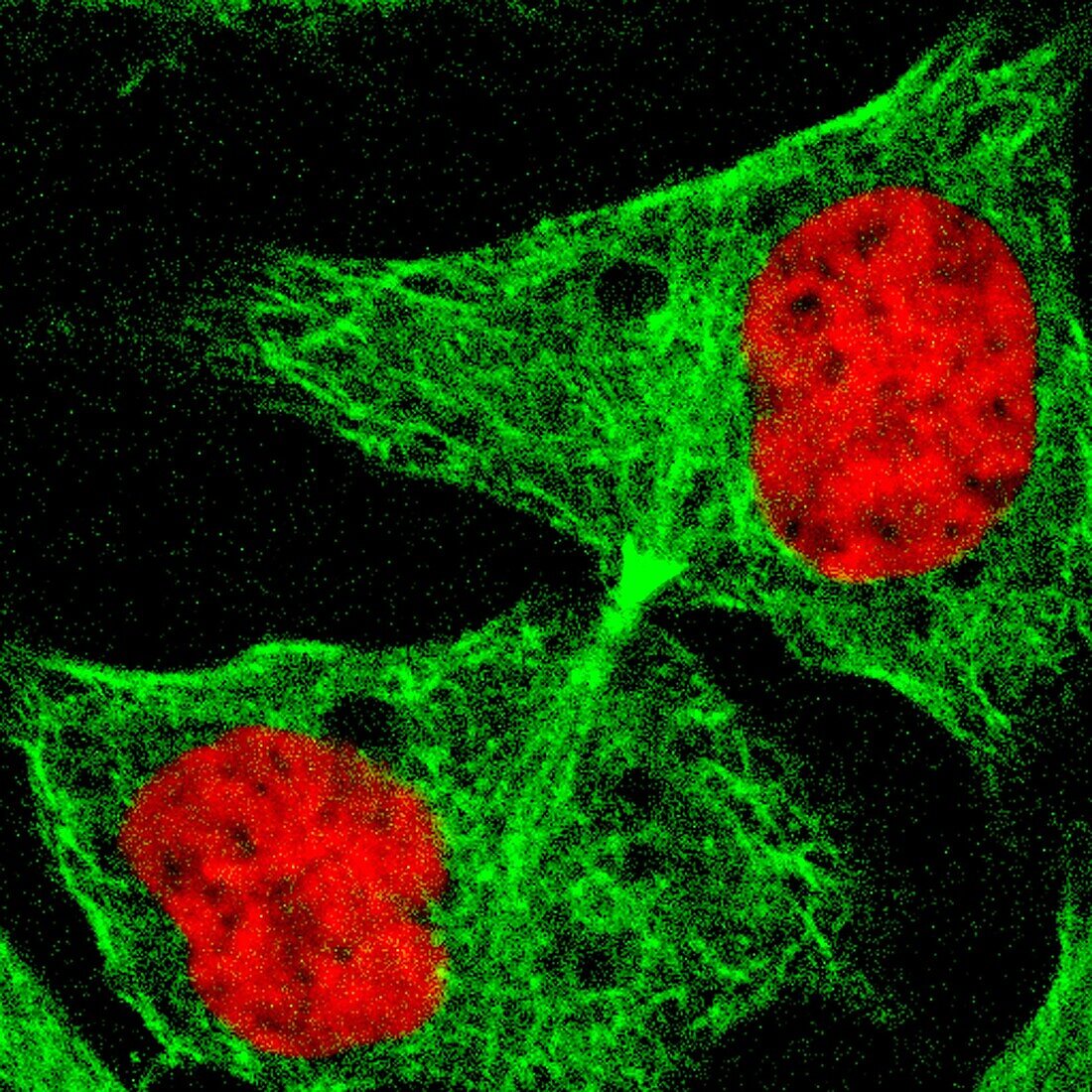 Human cell early in cytokinesis, light micrograph