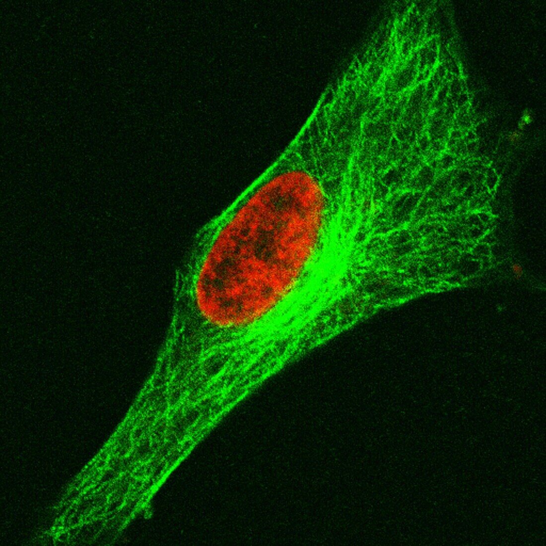 Human cell in interphase, light micrograph