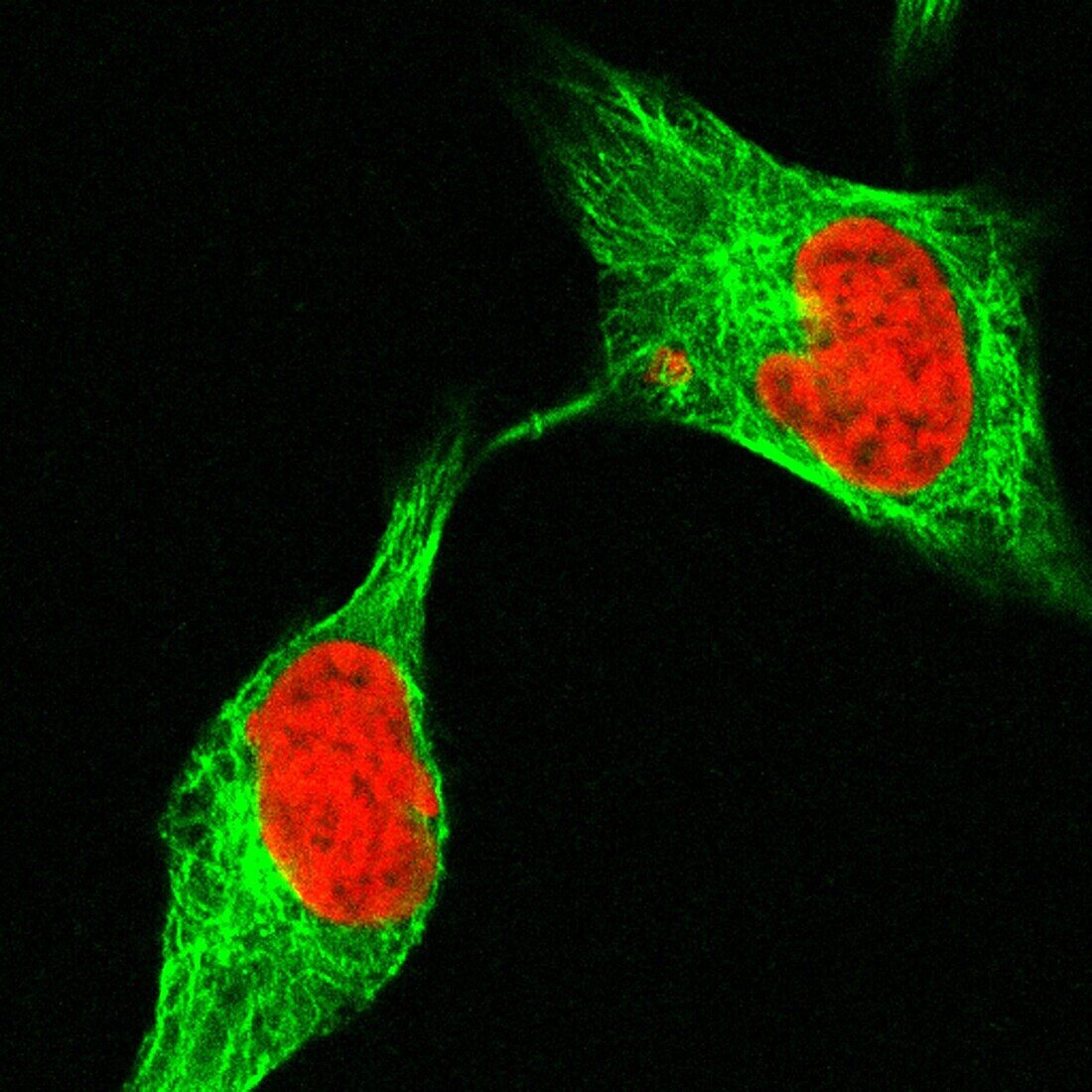 Human cell late in cytokinesis, light micrograph