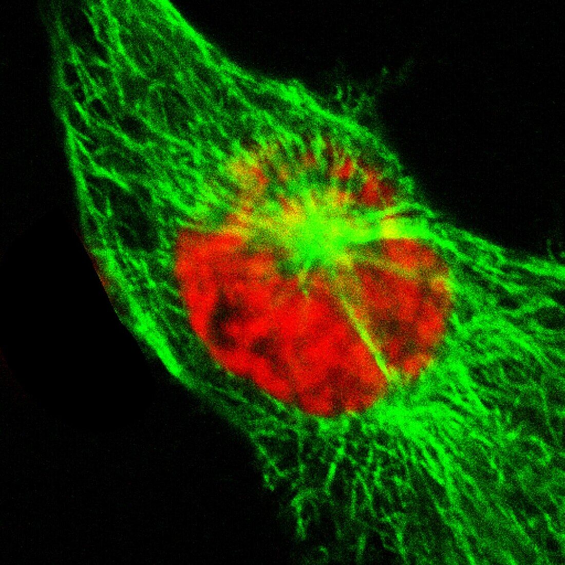 Human cell in early prophase, light micrograph
