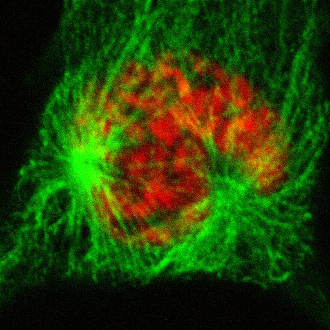 Human cell in late prophase, light micrograph