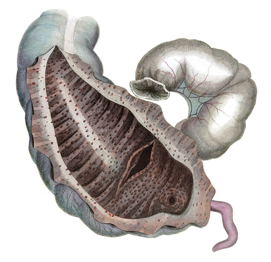 Caecum and colon, illustration