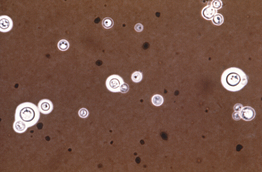Cryptococcus neoformans fungi, light micrograph