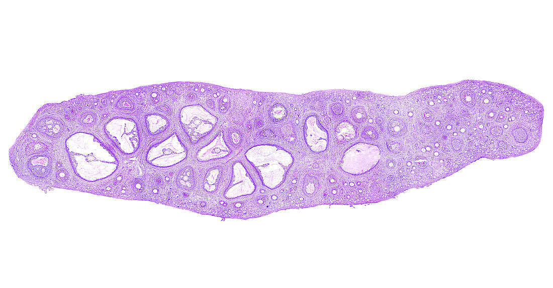 Ovarian follicles, light micrograph