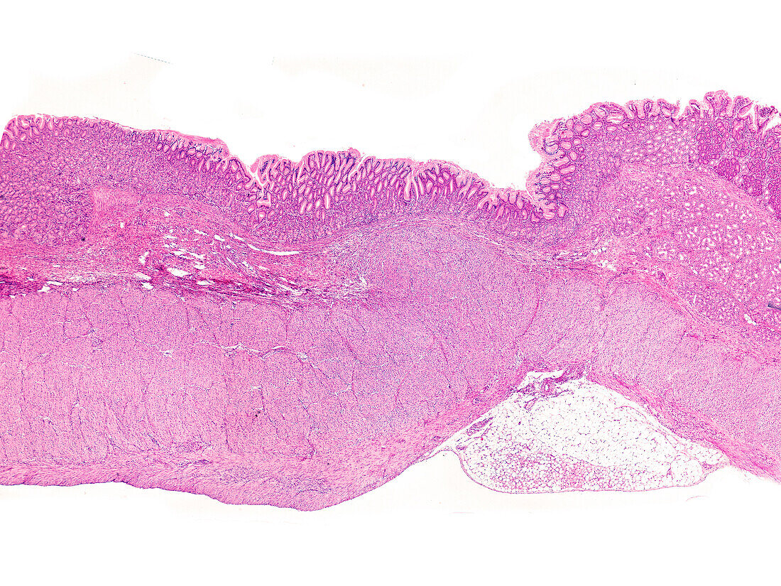 Pylorus of a human stomach, light micrograph