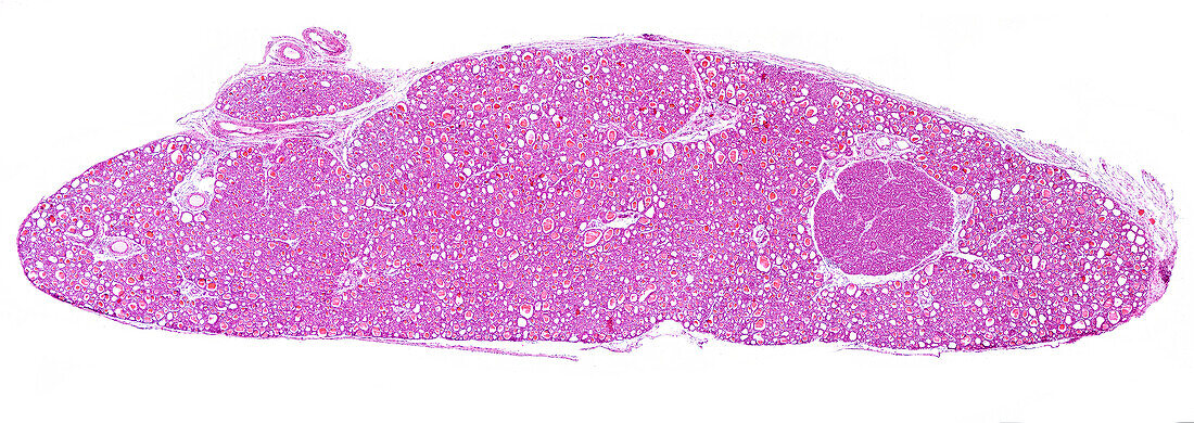 Thyroid and parathyroid gland, light micrograph