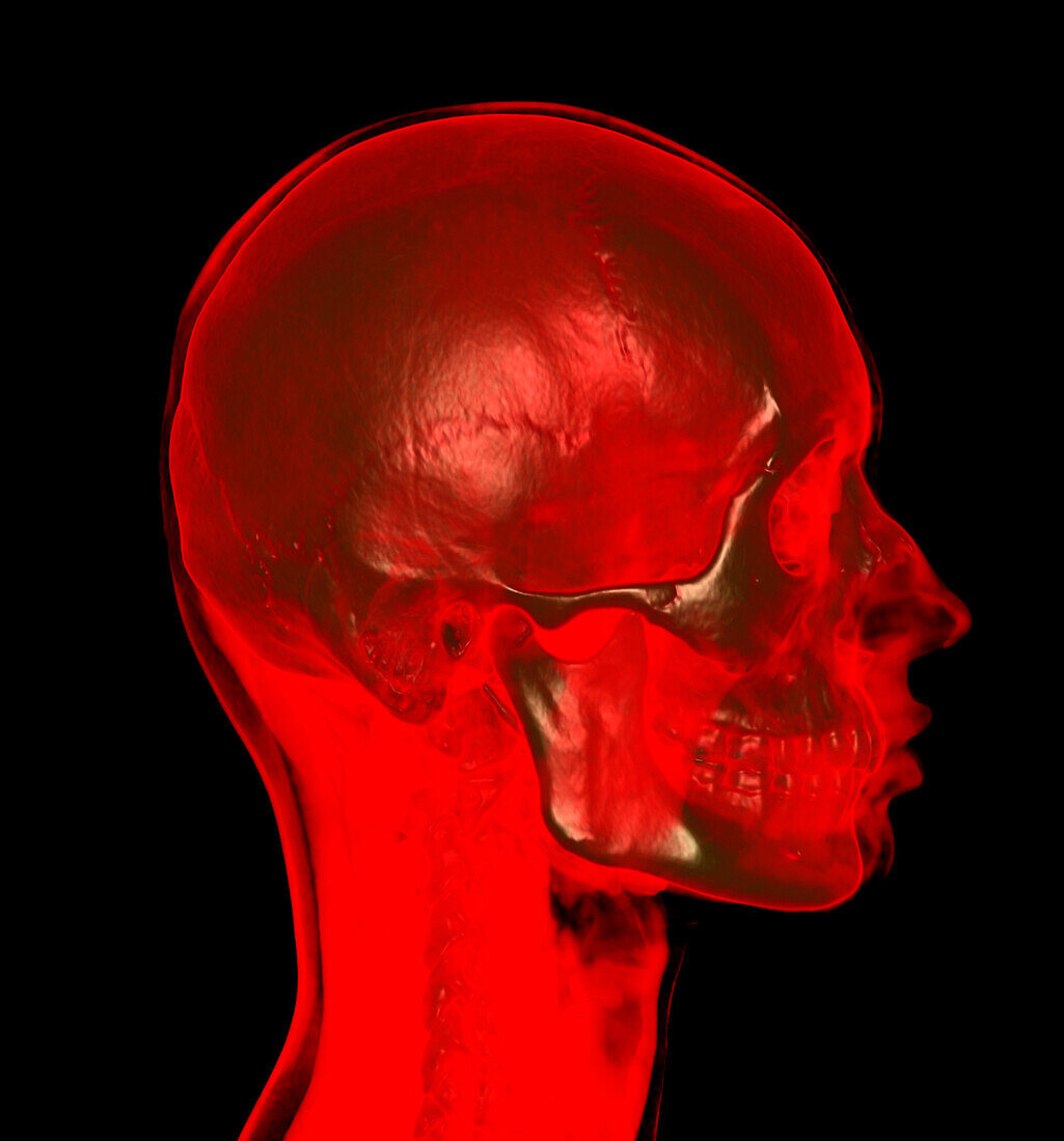 Bones of the skull and neck, CT scan
