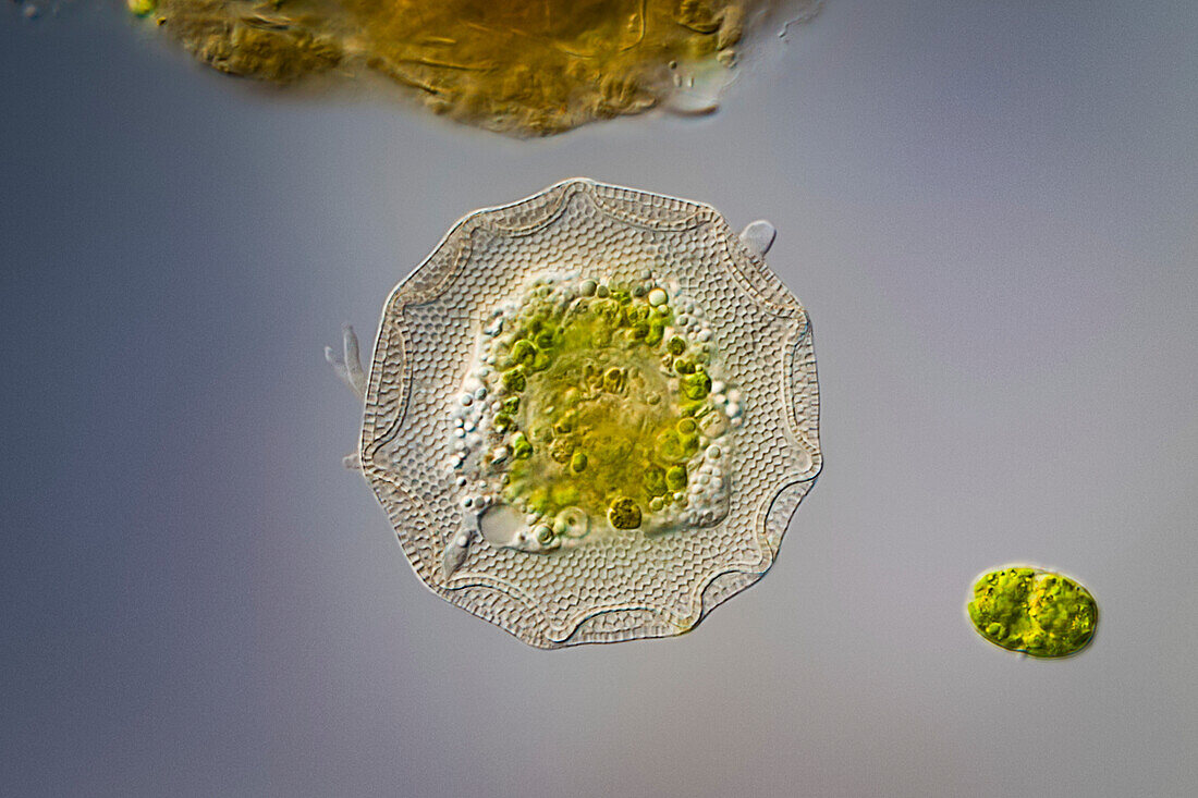 Testate amoeba, light micrograph