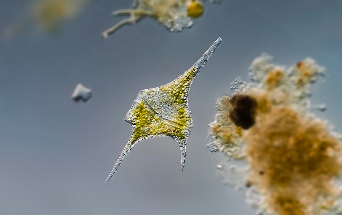Ceratium sp. dinoflagellates, light micrograph