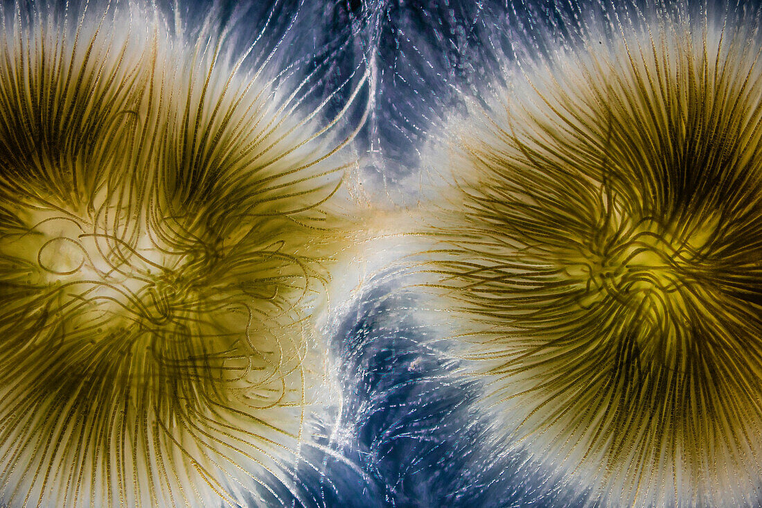 Gloeotrichia sp. cyanobacteria, light micrograph