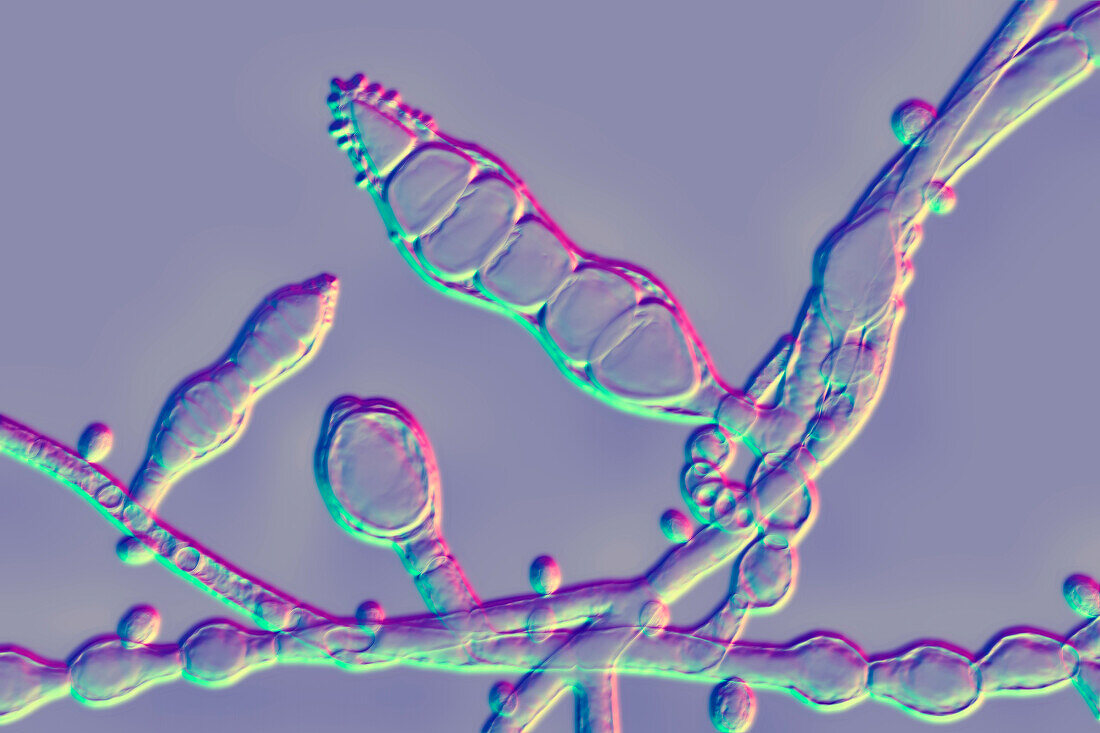 Microsporum audouinii fungus,