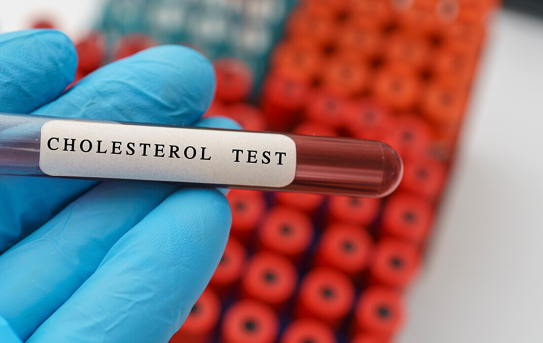 Cholesterol blood test, conceptual image