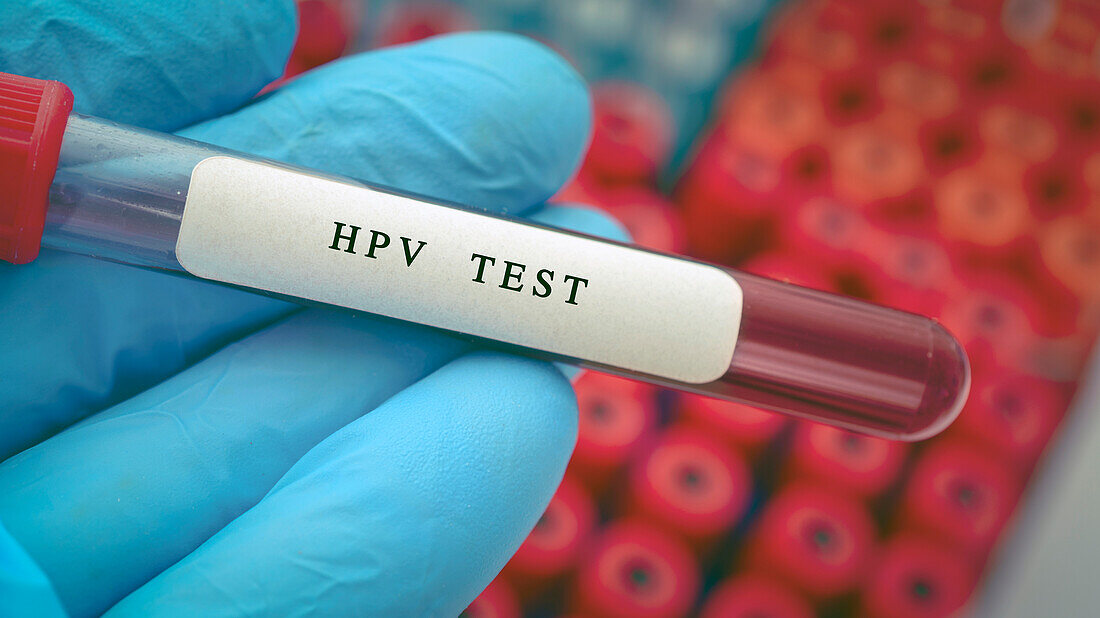 HPV blood test, conceptual image