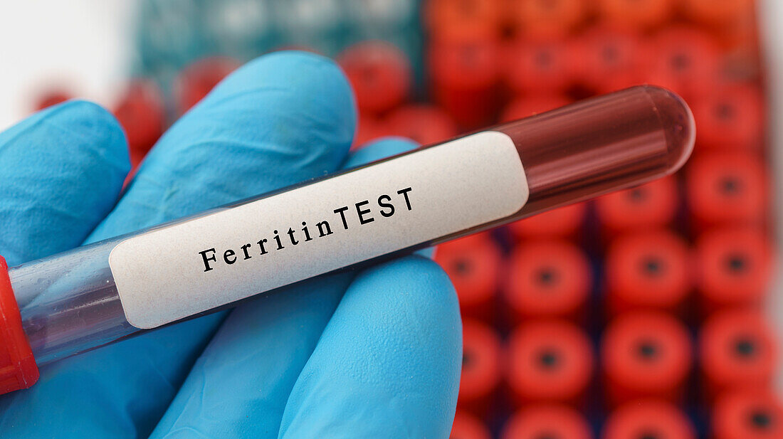 Ferritin test, conceptual image