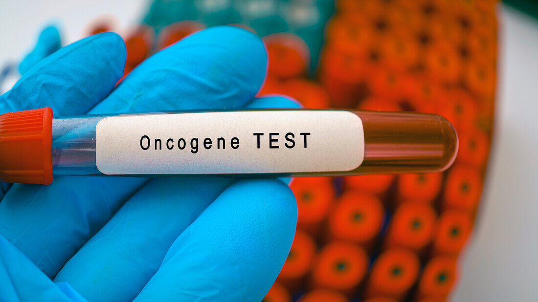 Oncogene test, conceptual image