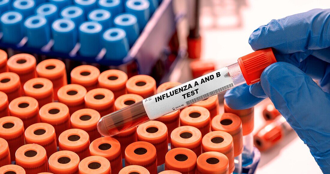 Influenza A and B blood test, conceptual image