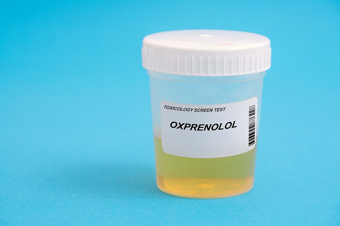 Urine test for oxprenolol