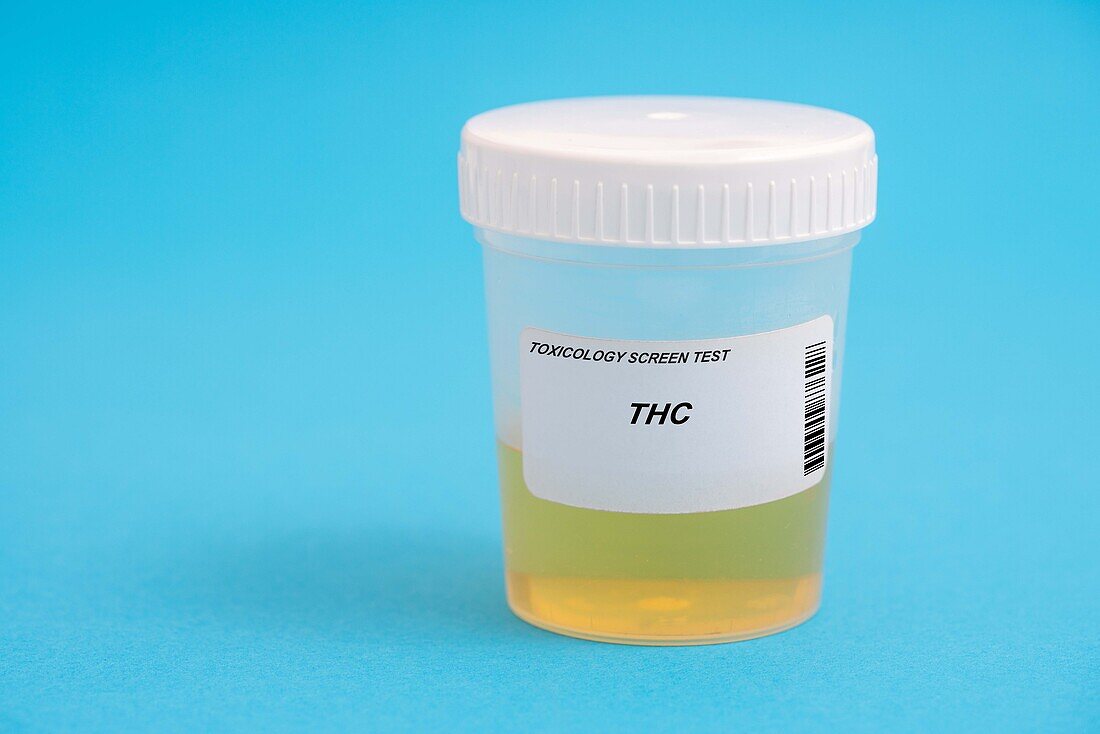Urine test for THC