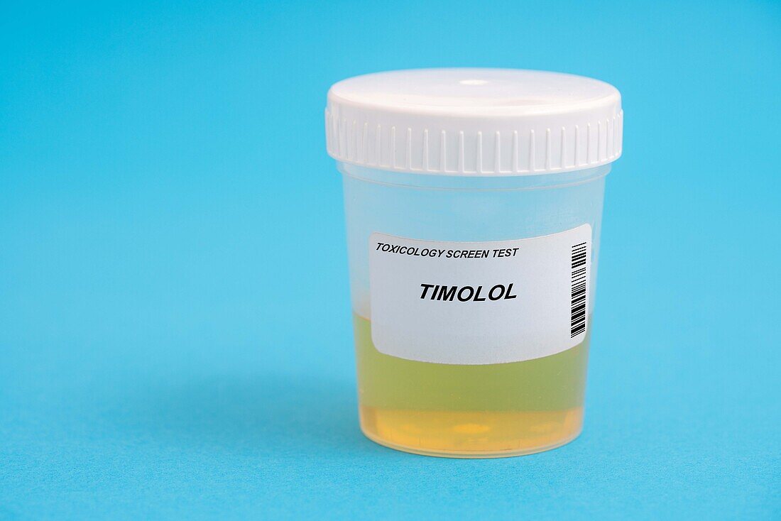 Urine test for timolol