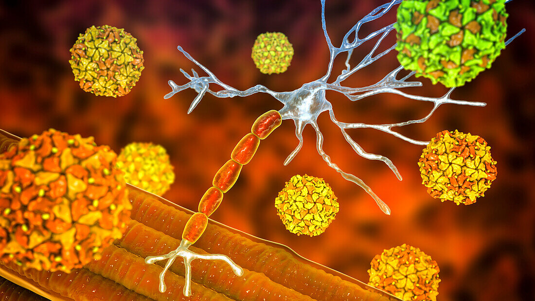 Polio viruses affecting motor neurons, illustration
