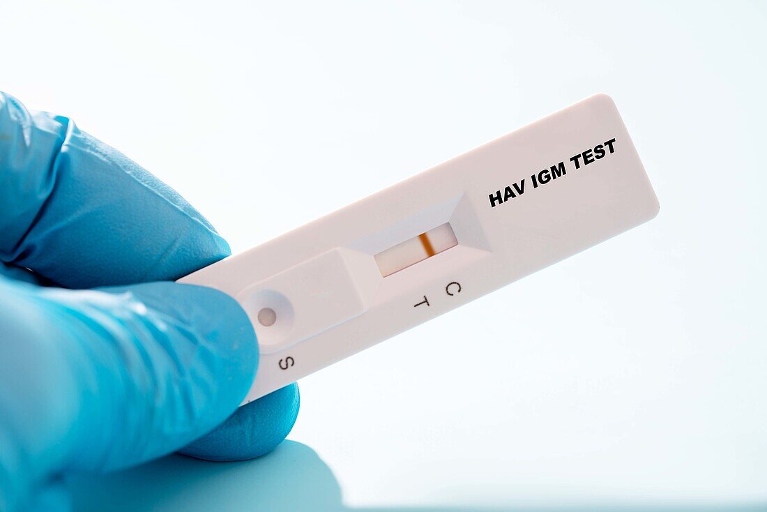 Negative Hepatitis A IgM rapid test, conceptual image
