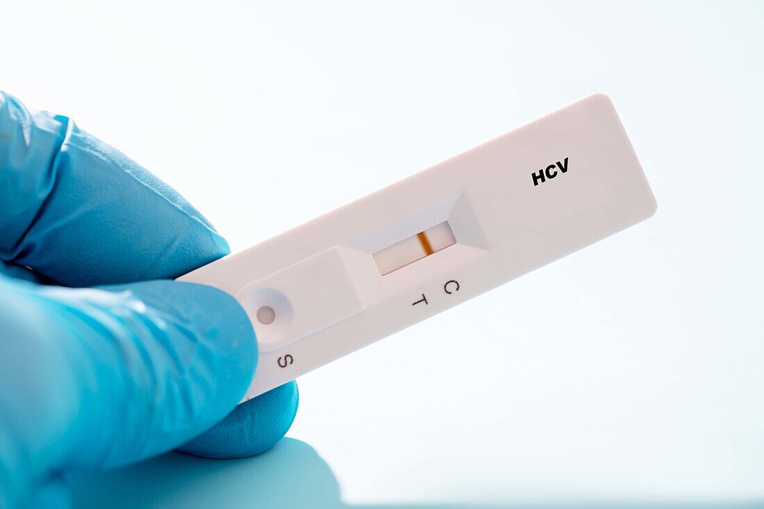 Negative Hepatitis C rapid test, conceptual image