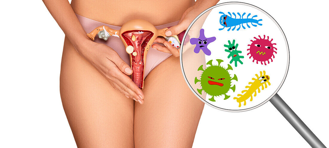 Sexually transmitted infections, conceptual image