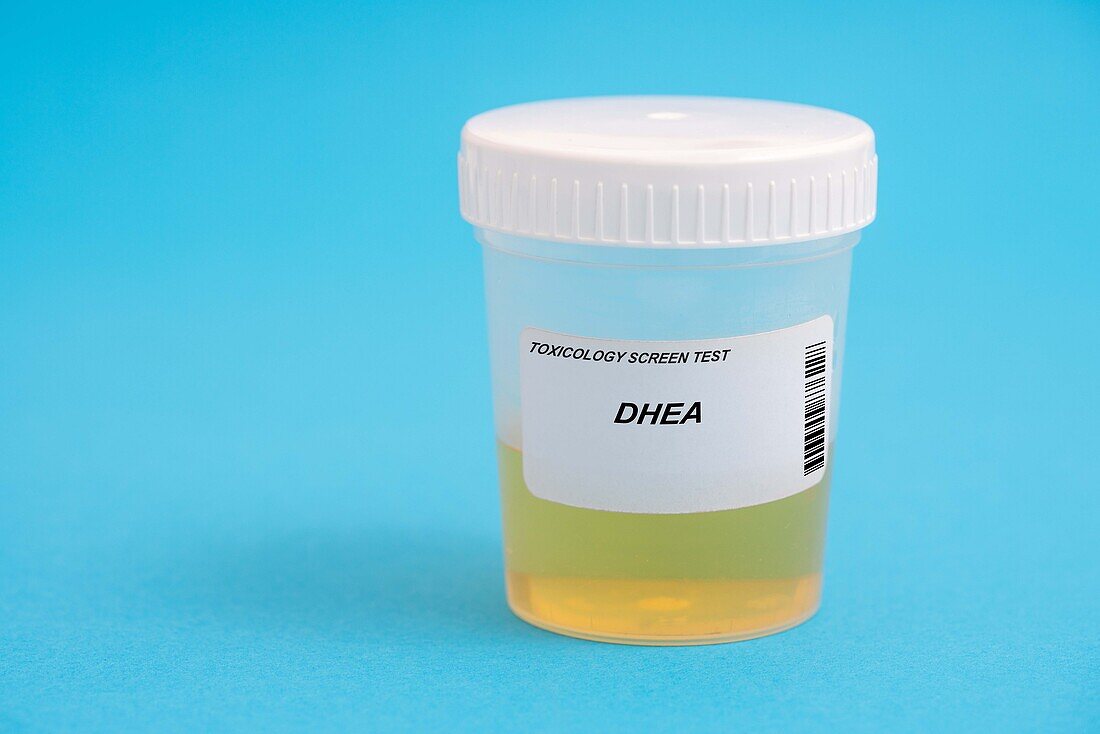 Urine test for DHEA