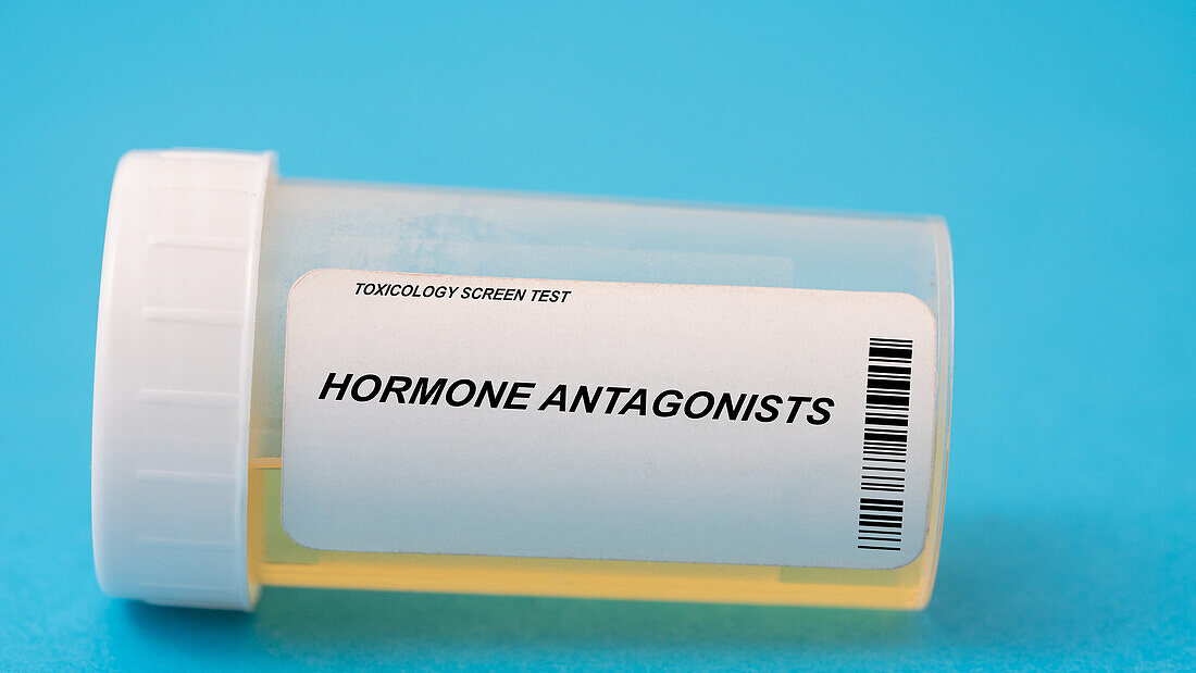 Urine test for hormone antagonists