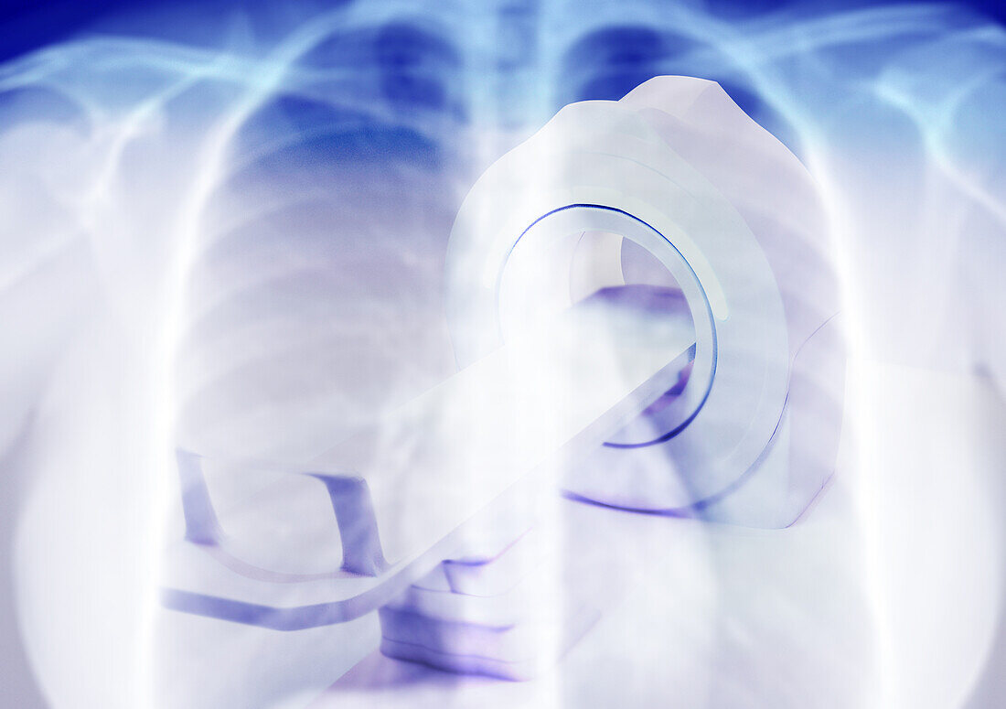 Lung disease diagnosis, conceptual image